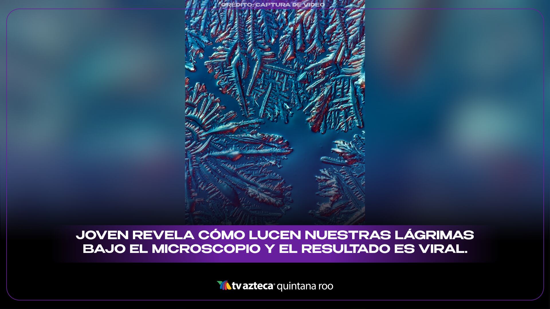 Ciencia asombrosa: Joven revela cómo lucen nuestras lágrimas bajo el microscopio y el resultado es viral.