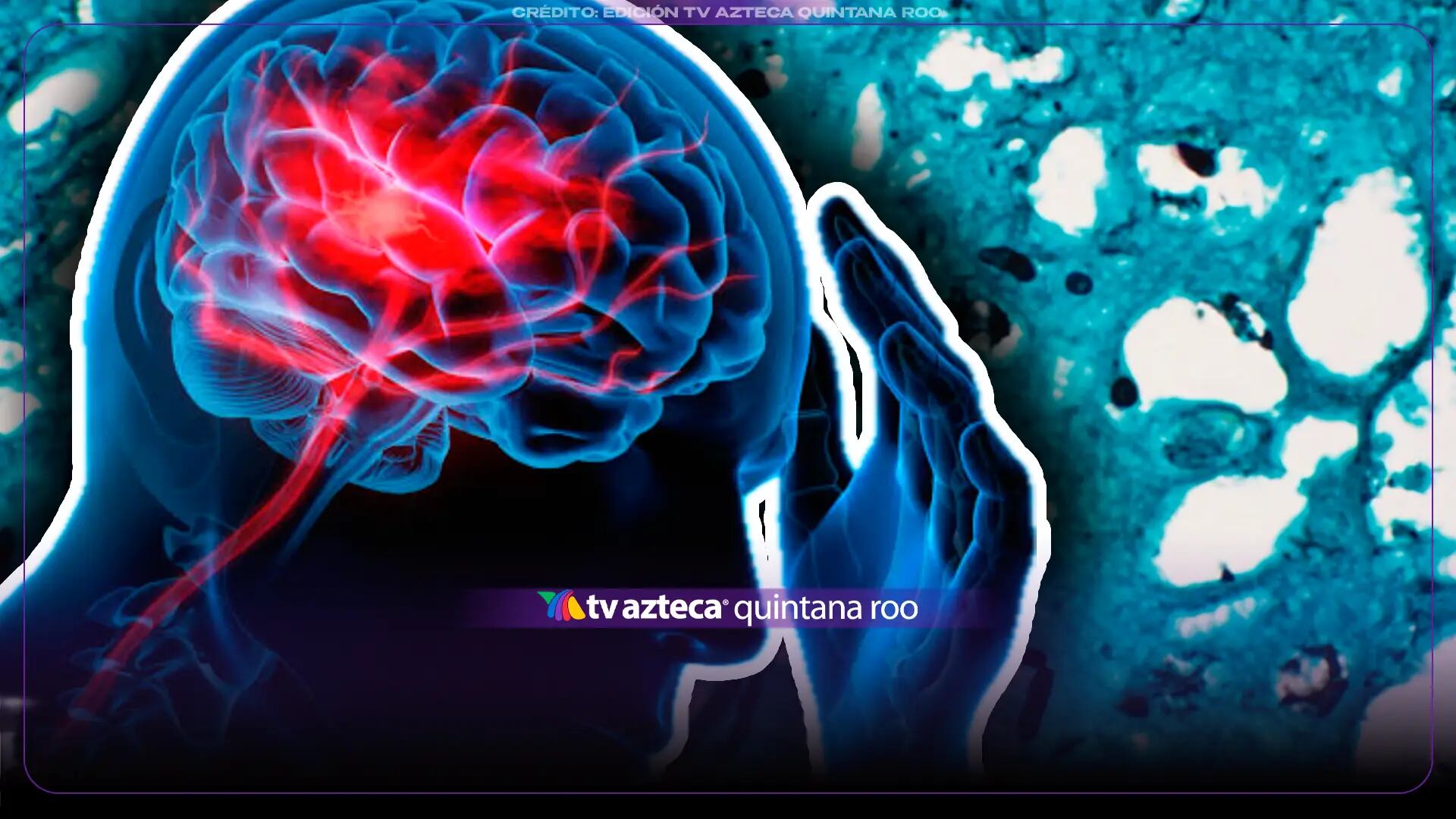 Aumento de casos de hongo mortal que ‘disuelve cerebros’ causa alerta: Mata al 70% de las personas infectadas